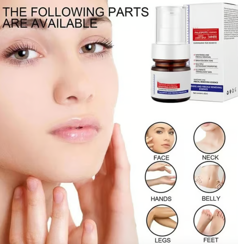Vitamin C Whitening Freckles Face Cream Remove Melasma Dark Spots Lighten Melanin